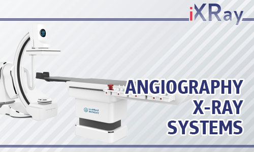 Mobile Digital Radiography Systems